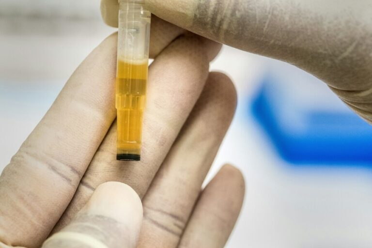 urine test biomarkers
