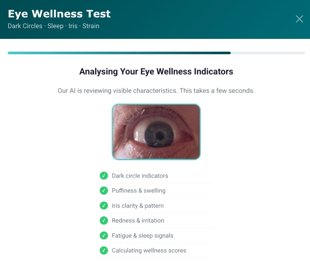 biomarks iris test1